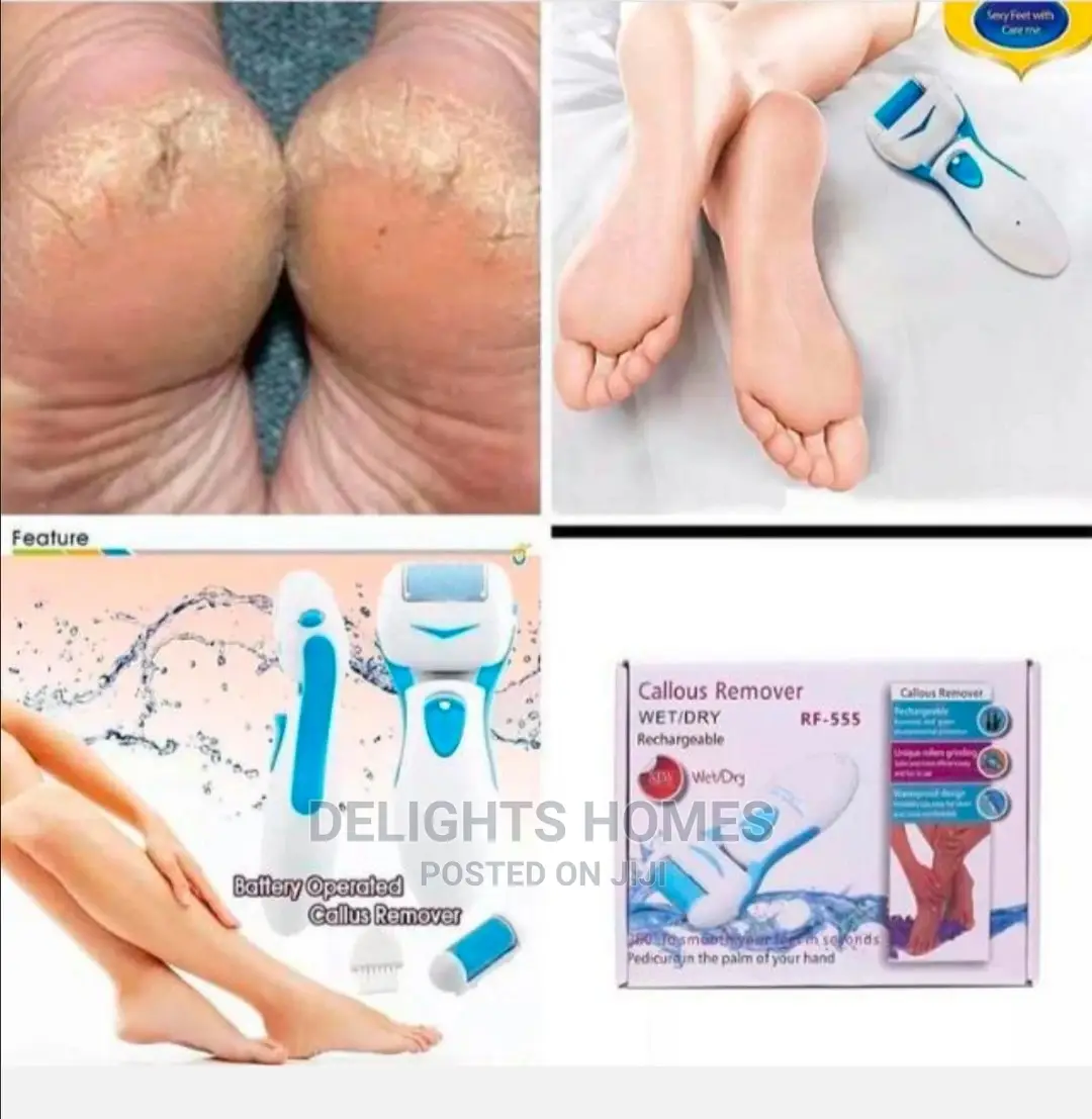 Rechargeable Callous Remover