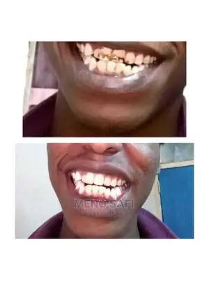 Dental Care And Issues