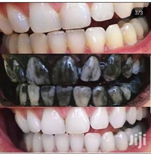 Charcoal Whitening Toothpaste