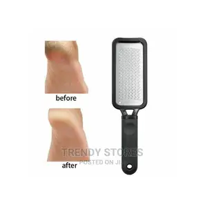 File Pedicure Callus Remover Hard Dead Skin Scrubber