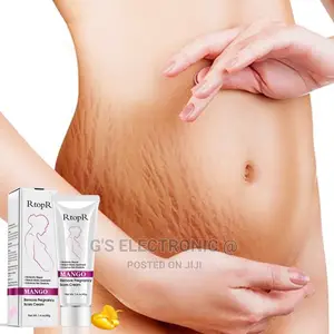 The Stretch Marks Cream