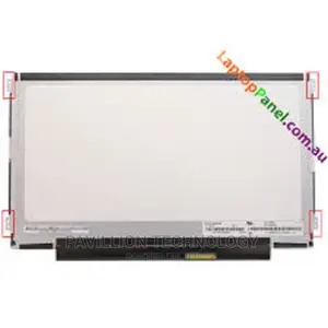 Lenovo Thinkpad X131e Screen