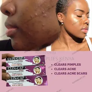Clin Cap Pimple and Razor Bump Cream/ Anti Acne Cream.