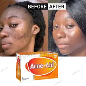 Acne Aid Soap Acne Soap Pimples Black Spots Cleanser