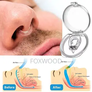*Anti-Snoring Device