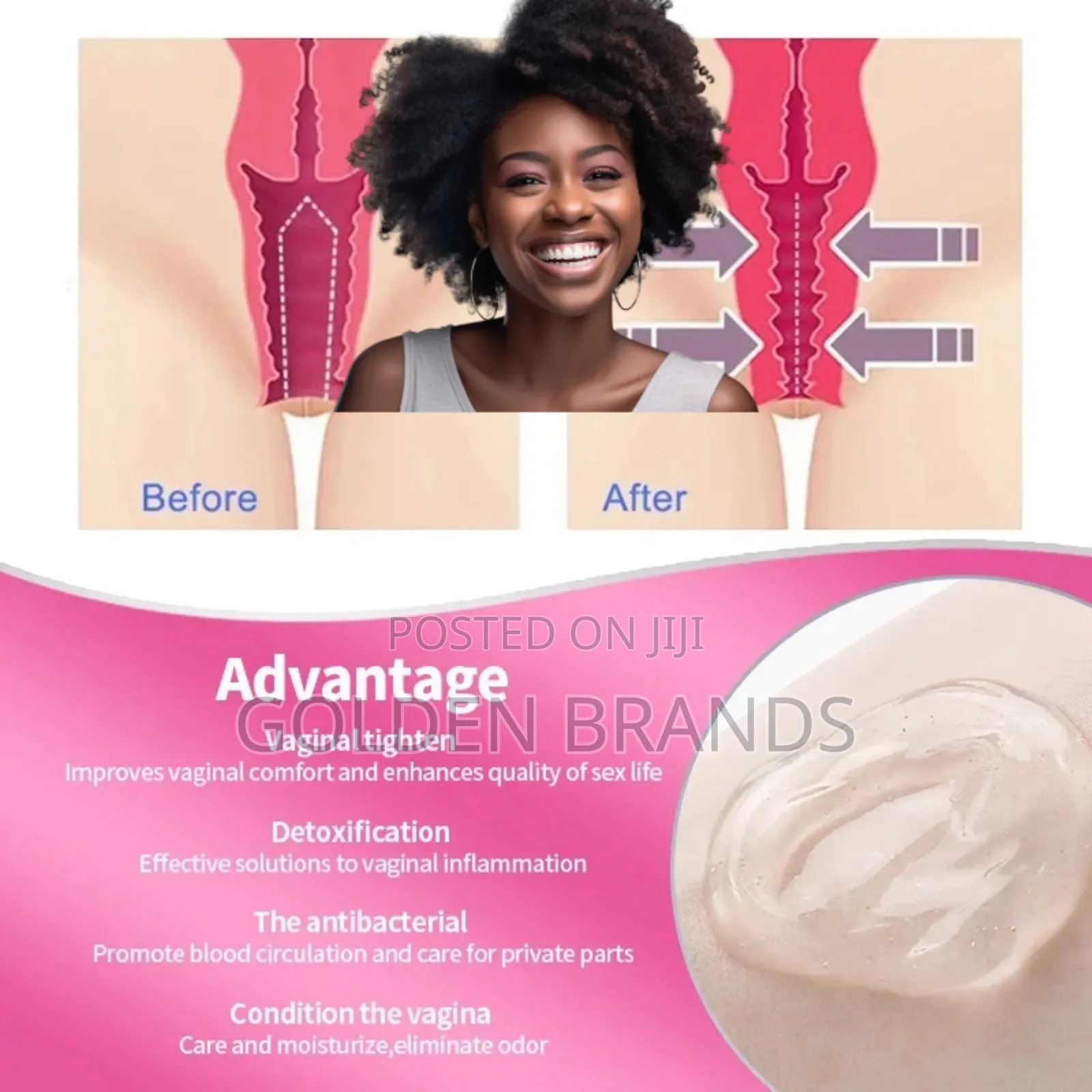 Super Vaginal Tightening Cream