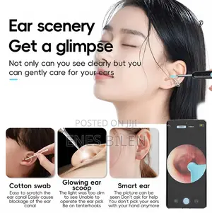 Smart Visual Ear Cleaner Set With Camera 1080P