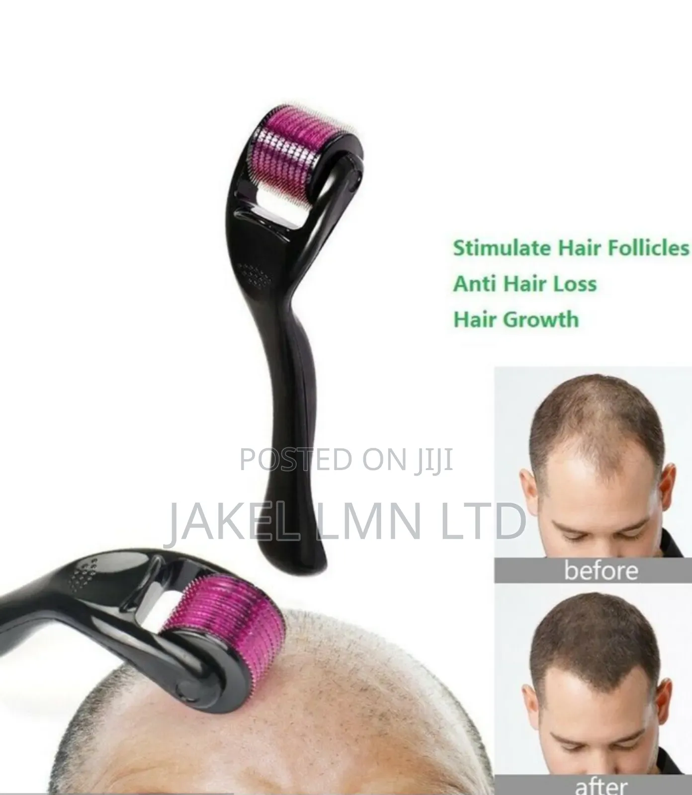 Microneedle Therapy System, 540 Derma Roller 0.5mm