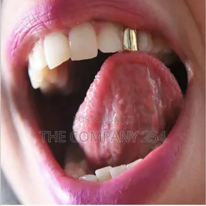 Quality Silver and Gold Temporary Tooth Grills Available