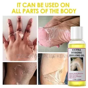 Extra Strong Peeling Oil for Dark Feet, Knuckles, Knees,