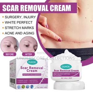 Quality Scar Removal Cream