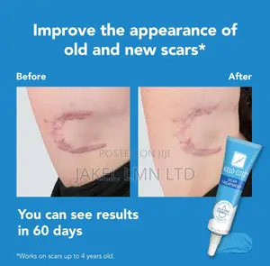 Kelo Cote Silicone Scar Gel Treatment- 15g