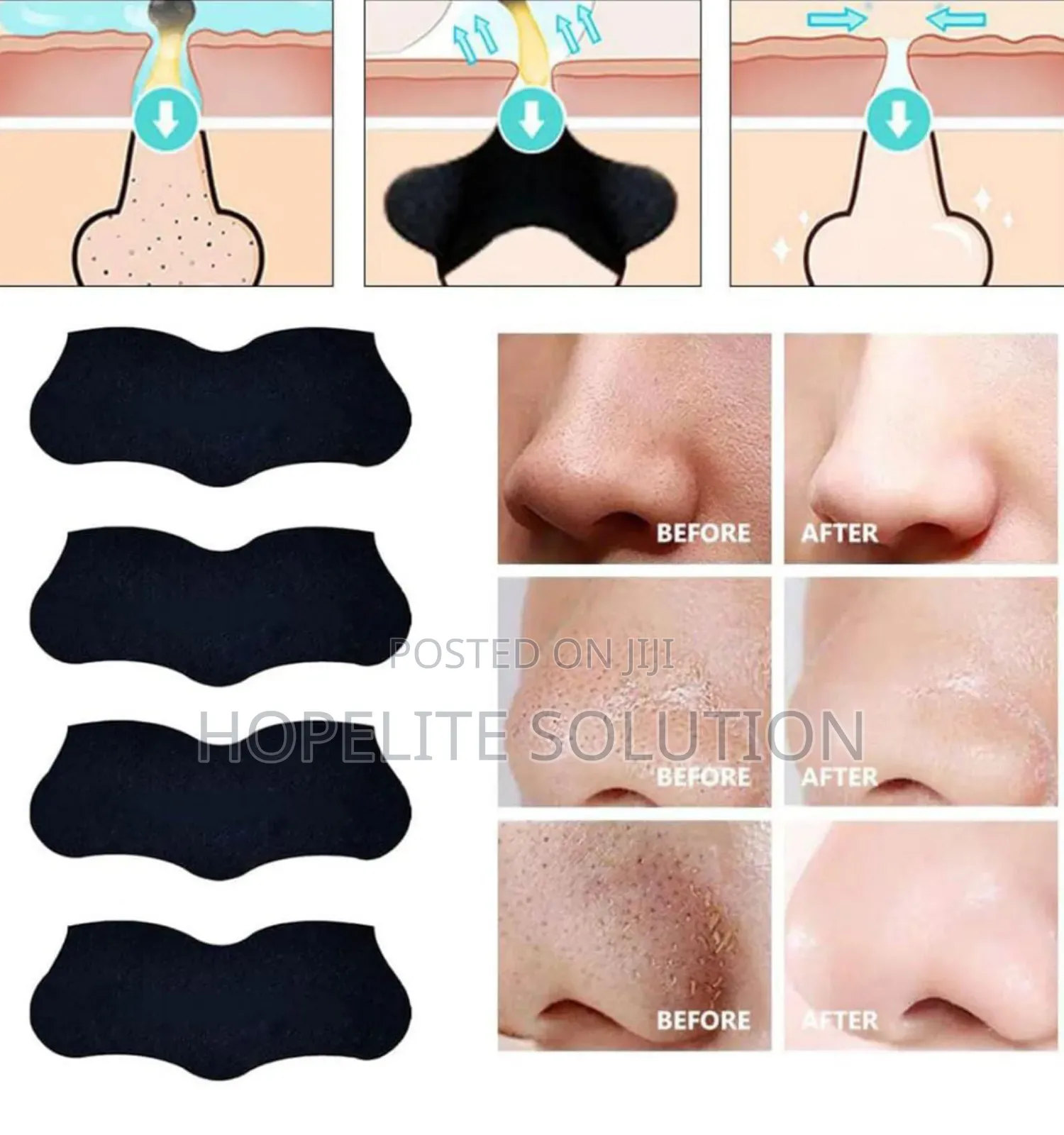 Blackheads Peel Off Strips