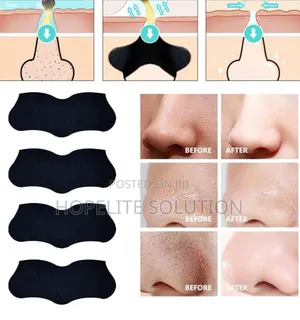 Blackheads Peel Off Strips
