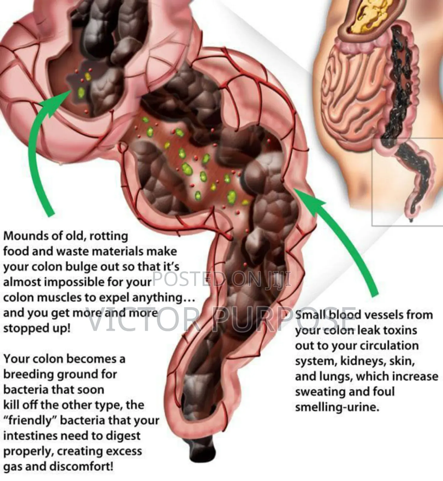 Superlife Colon Care (Scc+)