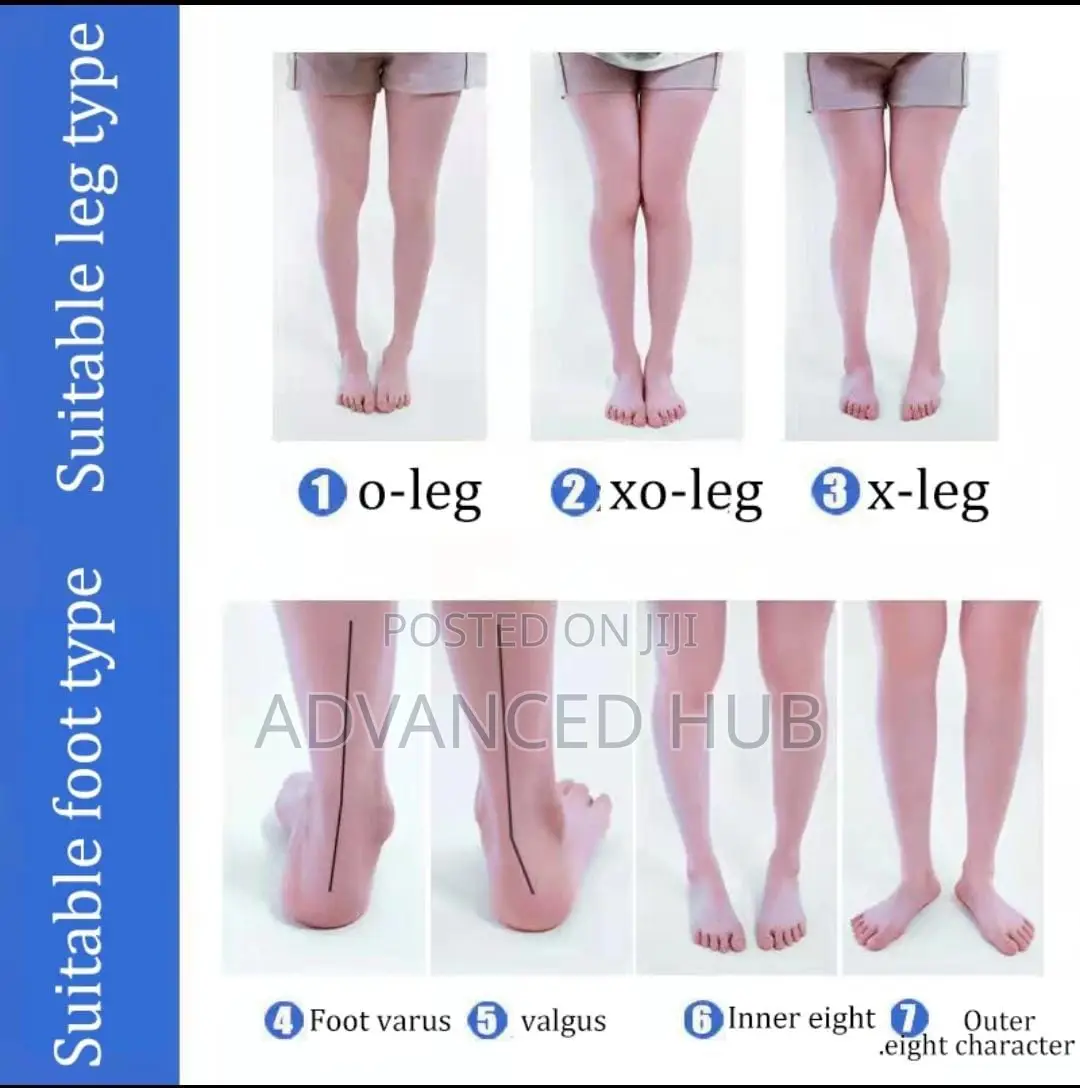 Silicone Orthopedic Insoles for Feet
