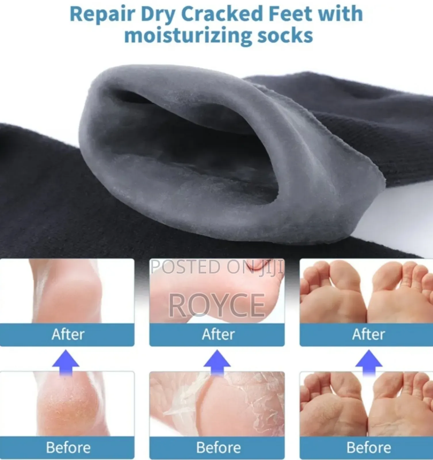 Moisturizing Gel Socks