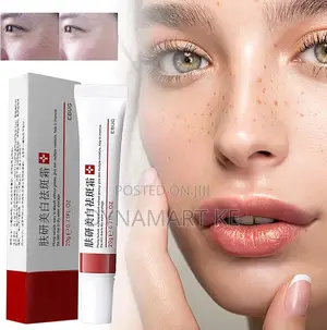 Dark Spot Corrector Cream Anti-Freckle Pigmentation Acne Scar Removal
