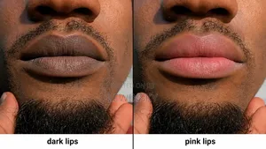 Our Famous Pink Lip Therapy