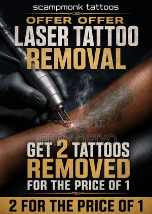 Laser Tattoo Removal