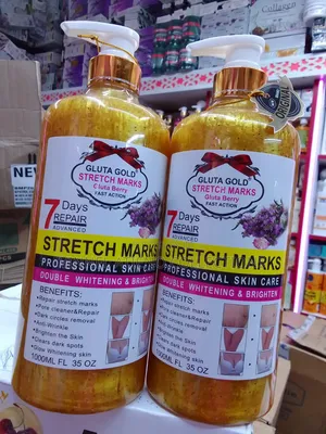 Stretch Marks