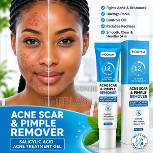 Fast Acne Scar Pimple Removal Gel –Smooth Skin Repair Cream 20g