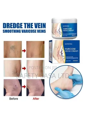 Vericose Vein Cream